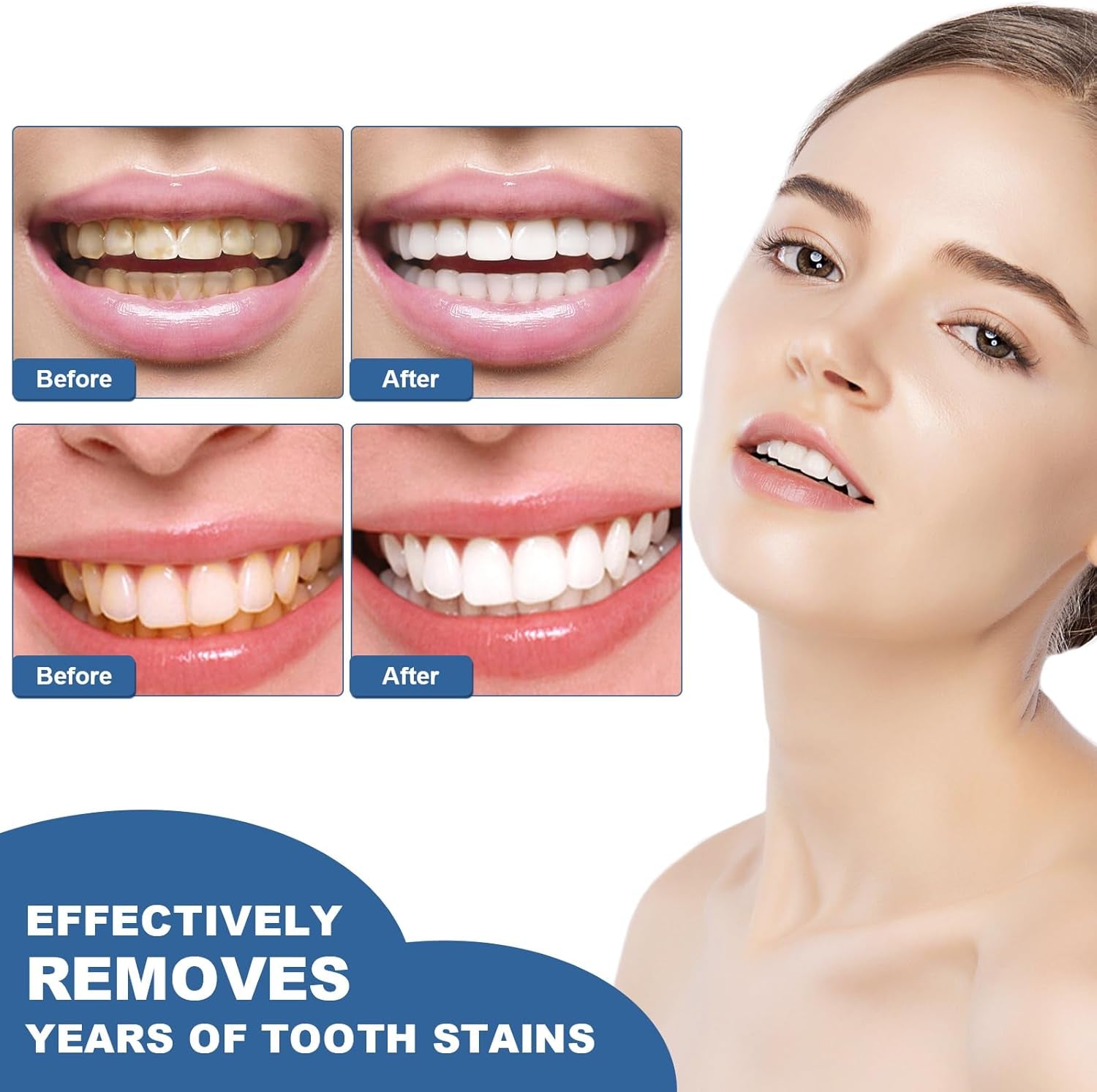 Teeth Whitening Essence Pen for Cleaning Teeth Stains, Freshening Breath and Reducing Yellowing (2Pcs)