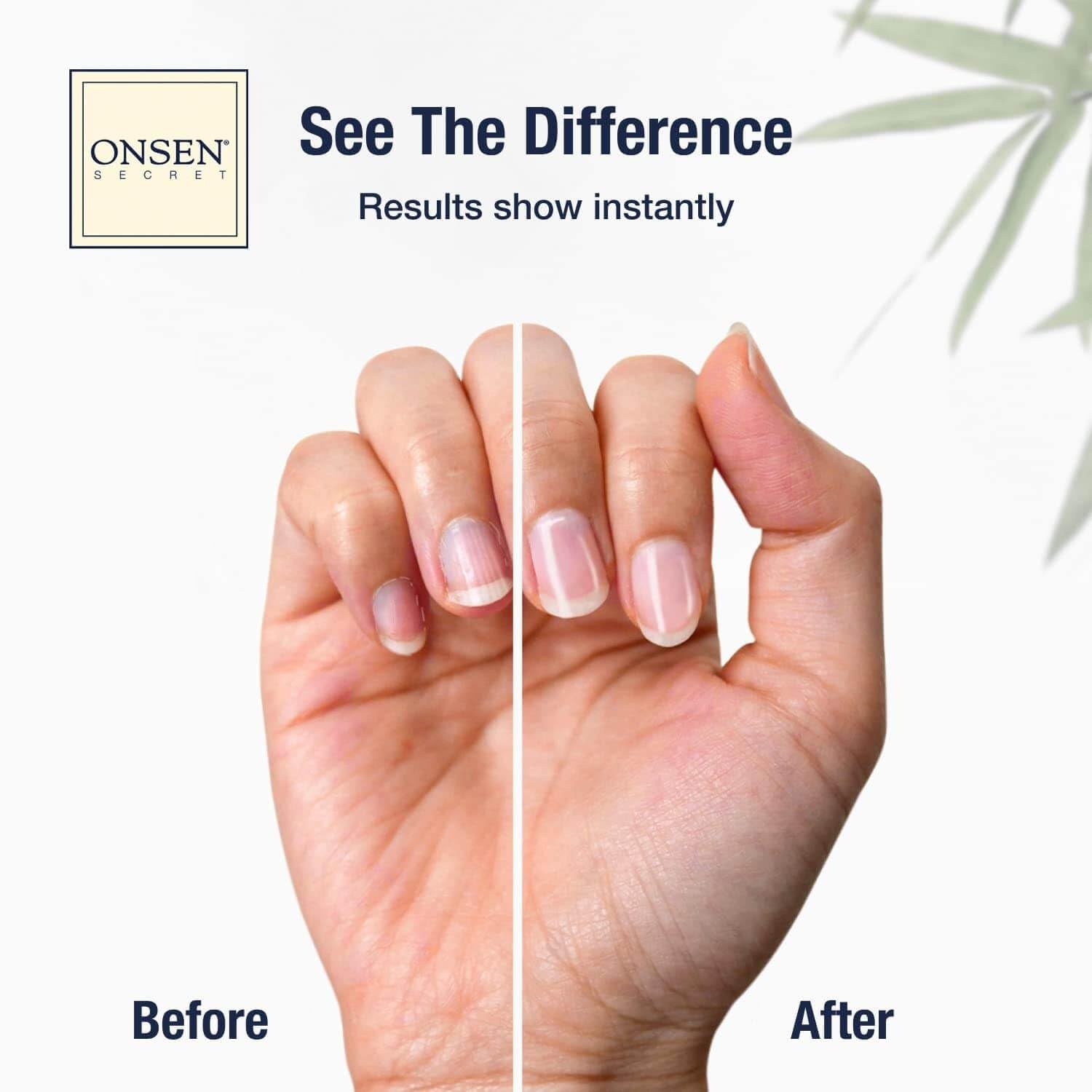 Nail Care Kit - W/Cuticle Care Serum, Japanese Nail Buffer and Shine Kit - Strengthening & Shining - Spa-Quality Manicure - Organic Ingredients - Long-Lasting Shine - Easy & Safe - 1Pk